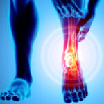 THREE SOURCES OF FOOT AND ANKLE PAIN AND HOW WE CAN HELP!